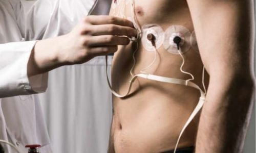 Cardiac-Stress-Test