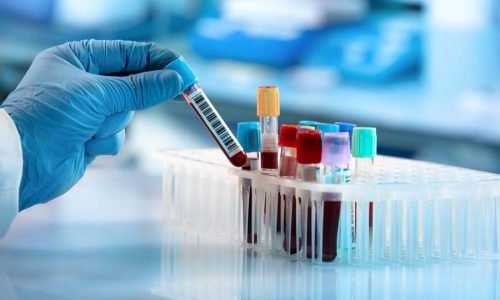 blood_test_samples_1200x750-59cd6b99366c6e716576ccd68351ed39